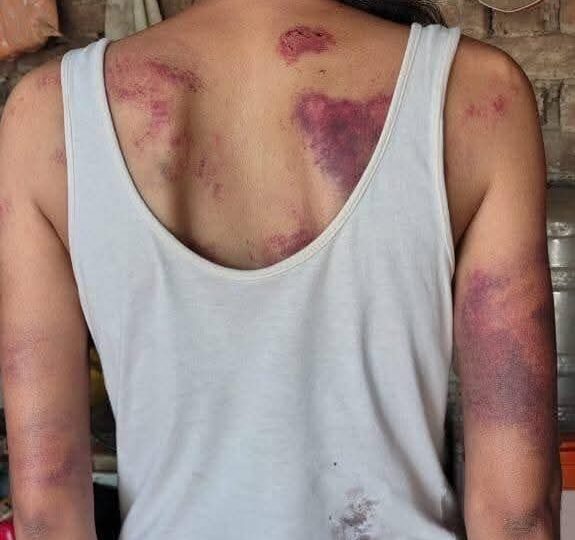 मुख्यमंत्र्याच्या लाडक्या बहिणीला मारहाण…! बीडमध्ये कायद्याचे राज्य आहे की नाही यावर प्रश्नचिन्ह