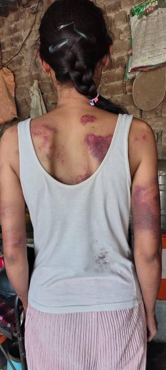 मुख्यमंत्र्याच्या लाडक्या बहिणीला मारहाण…! बीडमध्ये कायद्याचे राज्य आहे की नाही यावर प्रश्नचिन्ह